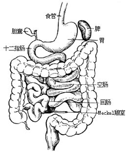 异位胰手术图片