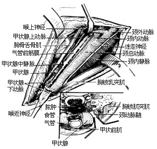 经颈结核病灶清除术图片