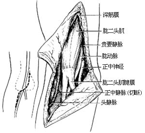 肱骨髁上骨折切开复位内固定术图片