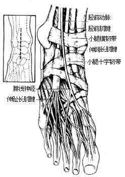 踝关节融合术图片