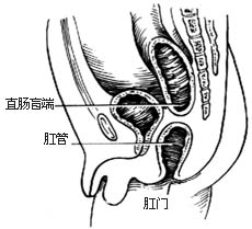 先天性直肠肛门畸形的手术图片