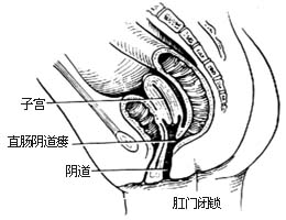 先天性直肠肛门畸形的手术图片