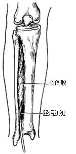 胫后肌腱转移术图片