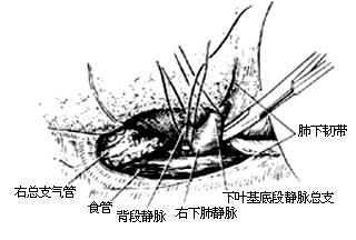 各部位肺切除术图片