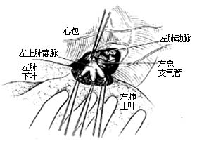 各部位肺切除术图片