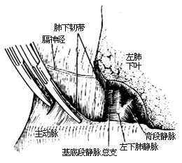 各部位肺切除术图片