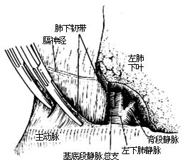 各部位肺切除术图片