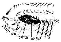 各部位肺切除术图片