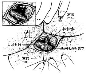 各部位肺切除术图片