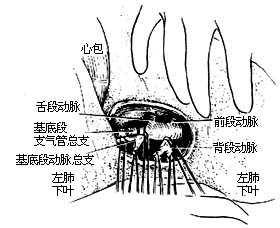 各部位肺切除术图片