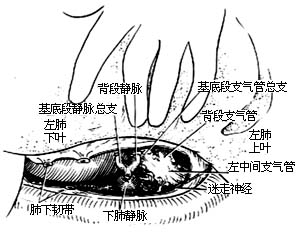 各部位肺切除术图片