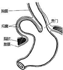 食管裂孔疝修补术图片