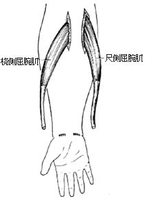 代前臂伸肌手术图片