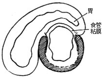 食管贲门肌层切开术图片