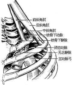 胸廓外成形术图片