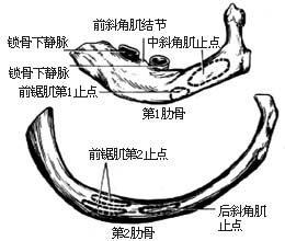 胸廓外成形术图片