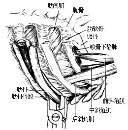 胸廓外成形术图片