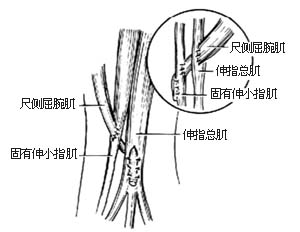 代前臂伸肌手术图片