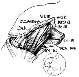 肩关节离断术图片