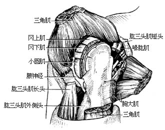 肩关节离断术图片