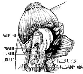 肩关节离断术图片