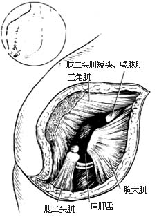 肩关节离断术图片