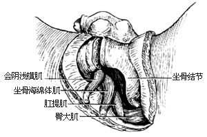 半骨盆截肢术图片