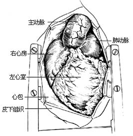 建立体外循环图片