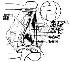 法乐四联症纠治术图片