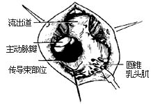 法乐四联症纠治术图片