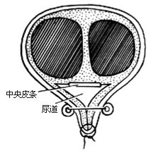 分期尿道下裂修复术图片