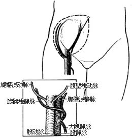 下腹部皮瓣切取术图片