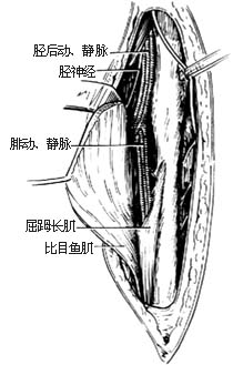 吻合血管的腓骨切取术图片