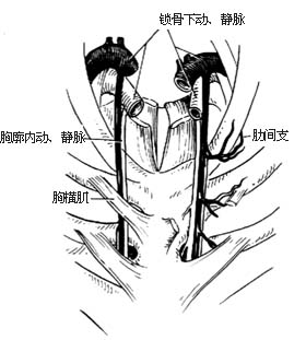 吻合血管的肋骨切取术图片