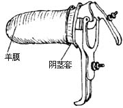 阴道成形术图片