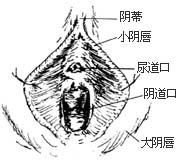 阴式全宫切除术图片