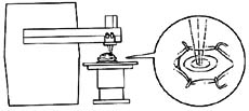 准分子激光屈光性角膜切削术图片