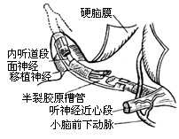 面神经手术图片