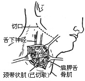 面神经手术图片