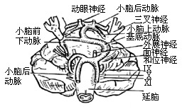 听神经瘤手术图片