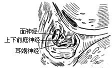 眩晕手术图片