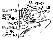 鼓室成形术图片