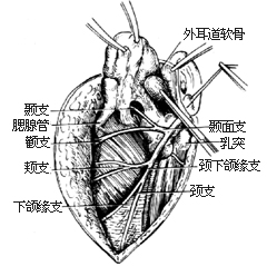 腮腺切除术图片