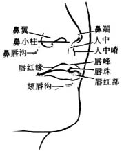 唇裂修复术图片