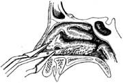 下鼻甲部分切除术图片