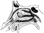 中鼻甲部分切除术图片