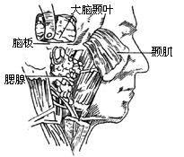 颞骨切除术图片