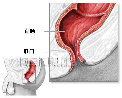 痔疮治疗术图片