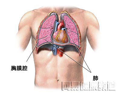 气胸治疗术图片