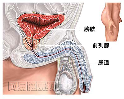 前列腺切除术图片